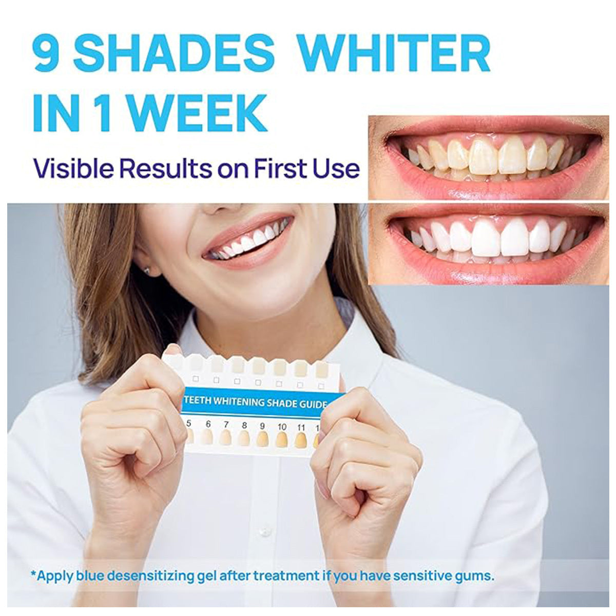 GlorySmile Teeth Whitening Kit